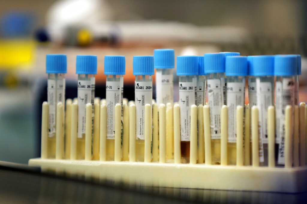 美國有科學家稱有證據證明新型冠狀病毒是天然產生的。AP資料圖片