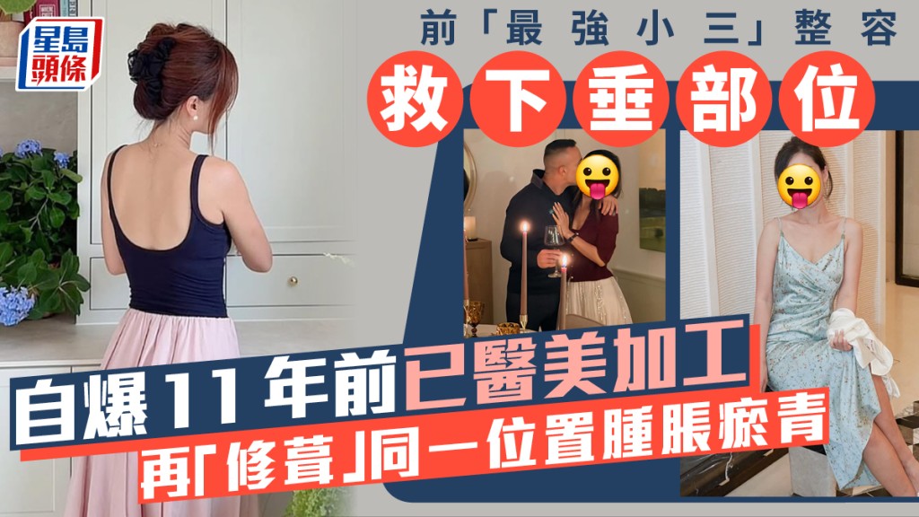 前「最強小三」整容救下垂部位  自爆11年前已醫美加工   再「修葺」同一位置腫脹瘀青