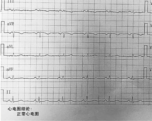 六旬婦打印心電圖答謝捐獻者。網上圖片