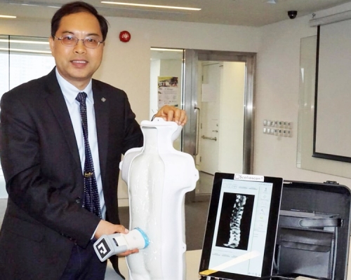 郑永平示范时指系统有助饰查出患有脊柱侧弯的青少年。