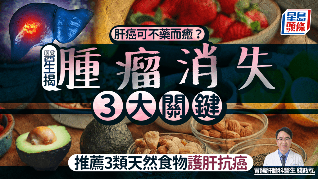 肝癌可不藥而癒？醫生揭腫瘤消失3大關鍵 推薦3類天然食物護肝抗癌