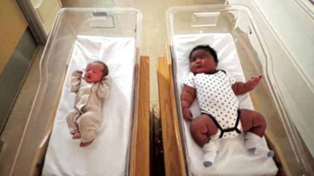 小尚恩（右）重达5.9公斤，与一旁的婴儿形成强烈对比。FB@Cayuga Health