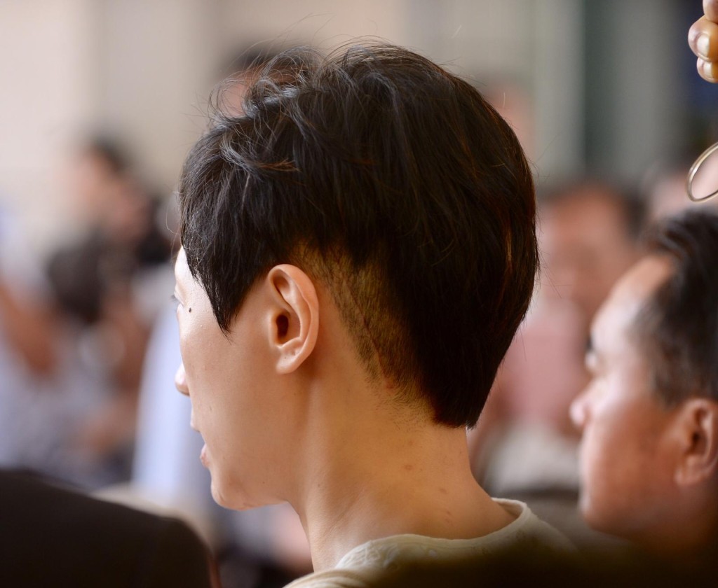 官指陳淑莊術後腦後有一條相當長的疤痕,不應是任何人為了逃避8個月監禁而冒的風險。