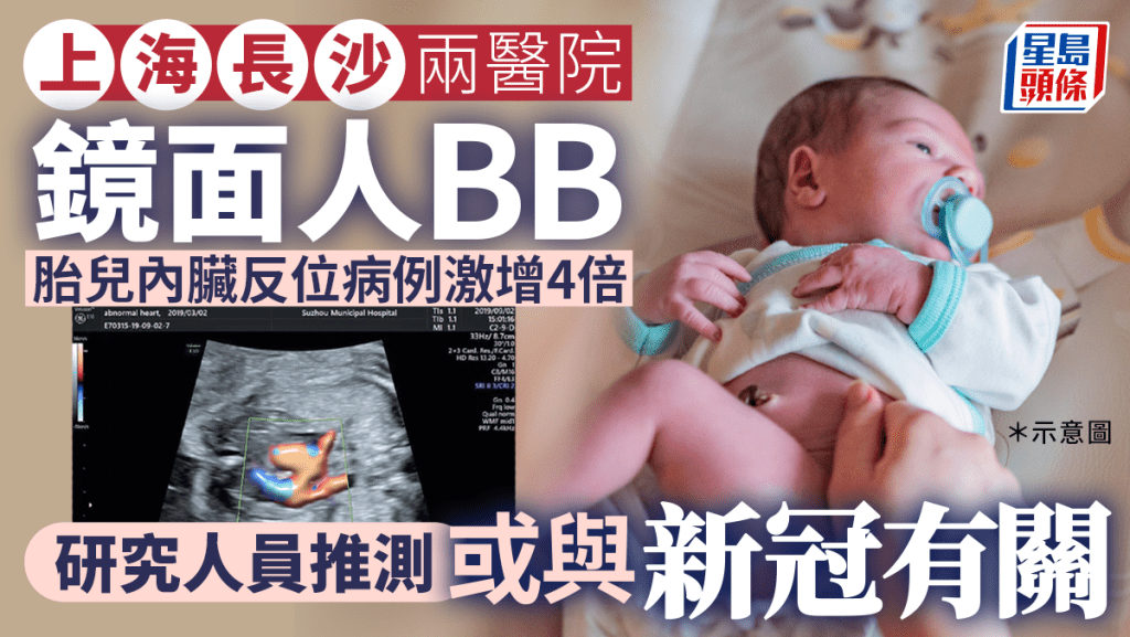 鏡面人BB ︱疑與新冠有關? 上海長沙兩醫院胎兒內臟反位增4倍