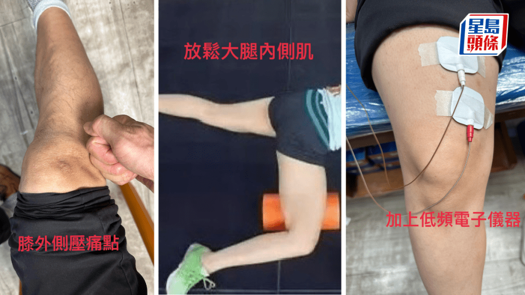 膝痛的隨身自我治療方案。圖片由筆者提供