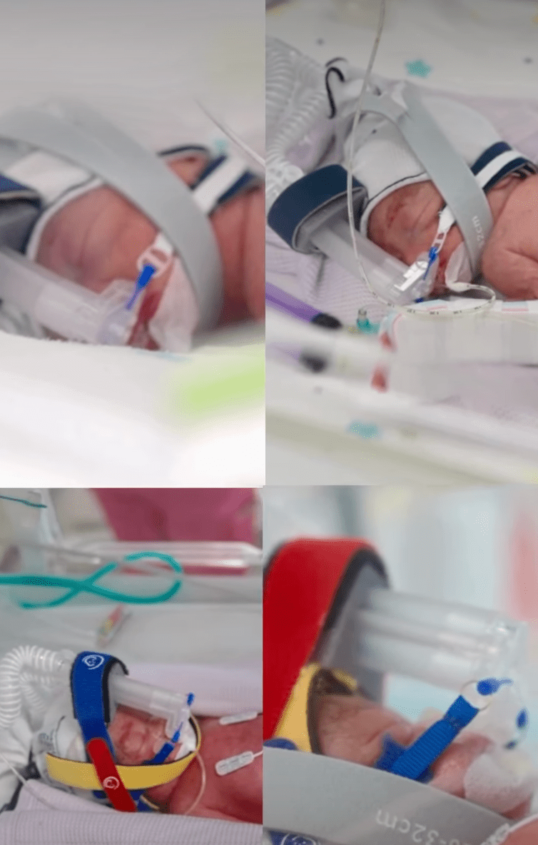 一名34歲澳洲婦人罕見地誕下同卵四胞胎。IG@metronorthhealth(下同) 