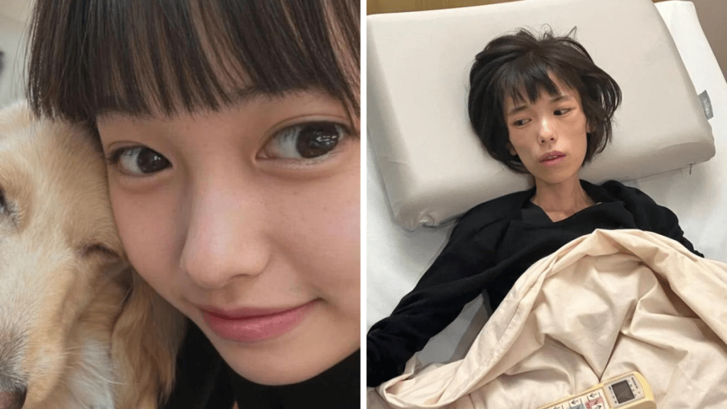 日16歲少女遭警扣留18日患PTSD，暴瘦至約20kg「皮包骨」亡。