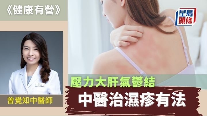 压力大肝气郁结 中医治湿疹有法｜健康有营