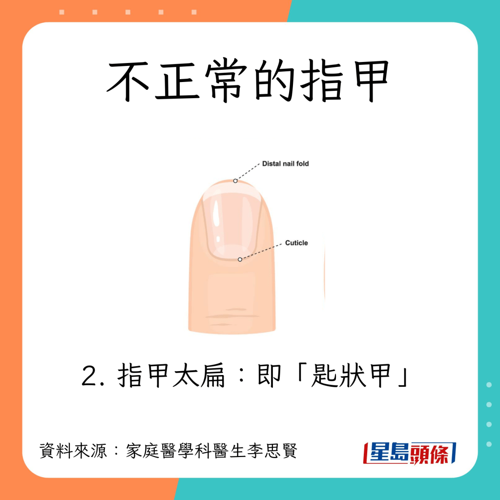 不正常指甲:匙狀甲