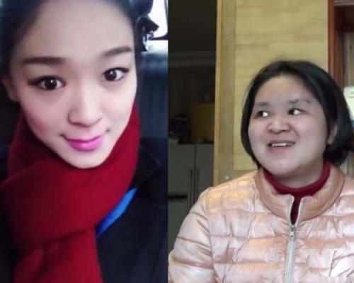 四川航空一名空姐三年前出差期间在酒店堕楼，导致她脸部毁容，智商受损，更失去事发当日的记忆。(网图)