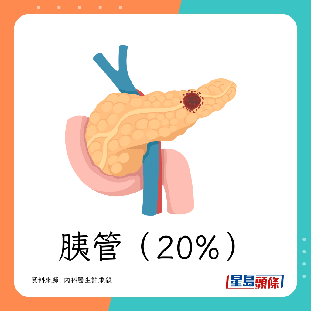 胰管（20%）