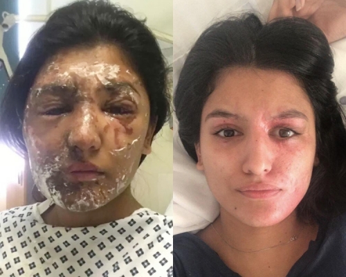 瑞斯韩的面貌已经变回平滑。