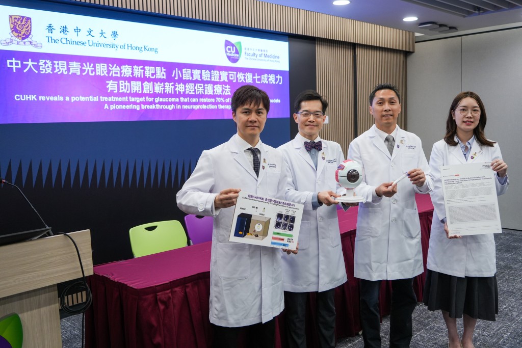 左起：中大醫學院眼科及視覺學系副教授（臨床）陳培文、中大醫學院眼科及視覺學系系主任譚志勇、副教授朱偉傑、童妍。