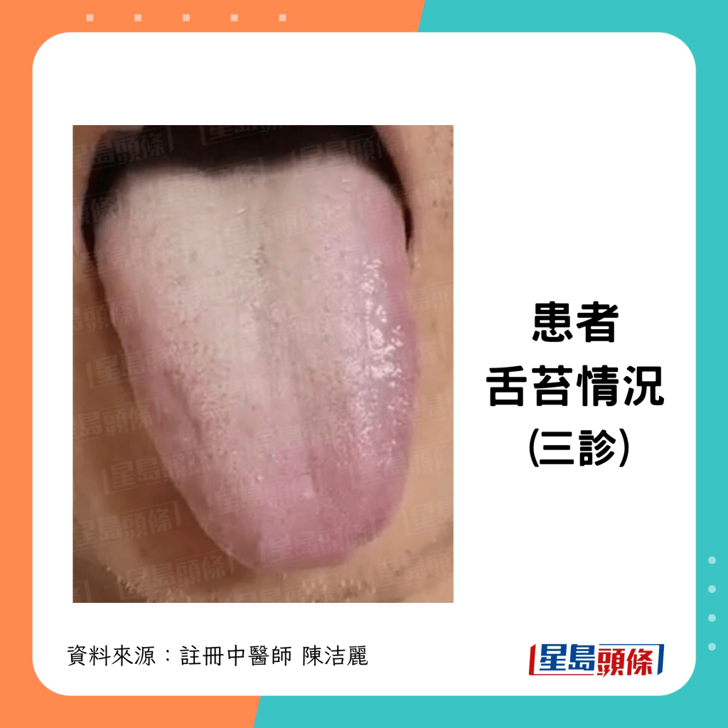 三診時舌苔情況