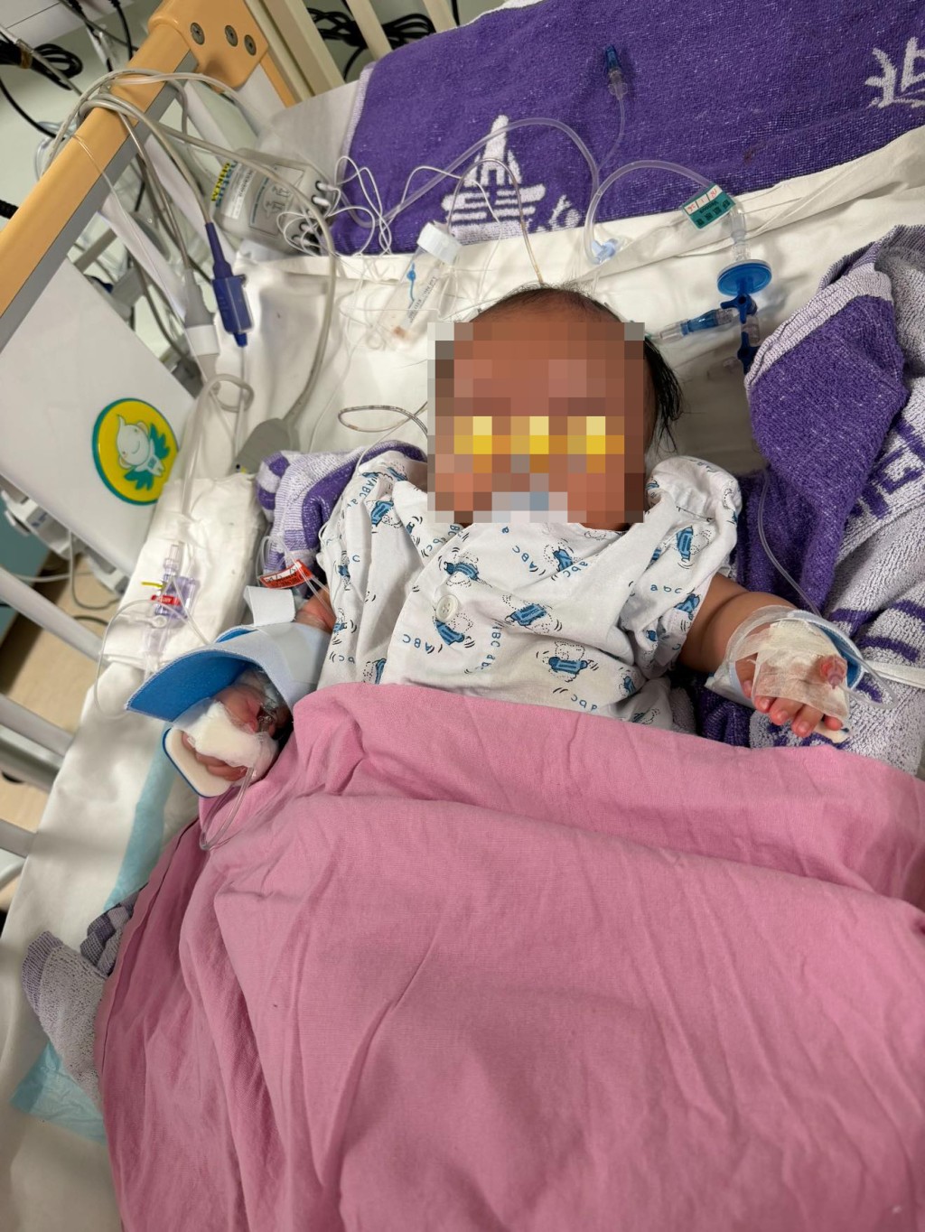 盧先生指兒子「細波」早前已接受手術，現時留醫兒童深切治療部。網上圖片