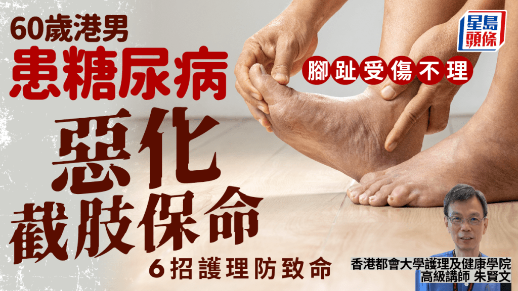 糖尿病截肢｜60歲港男患糖尿病 腳趾受傷不理須截肢保命 專家教清洗傷口6大方法