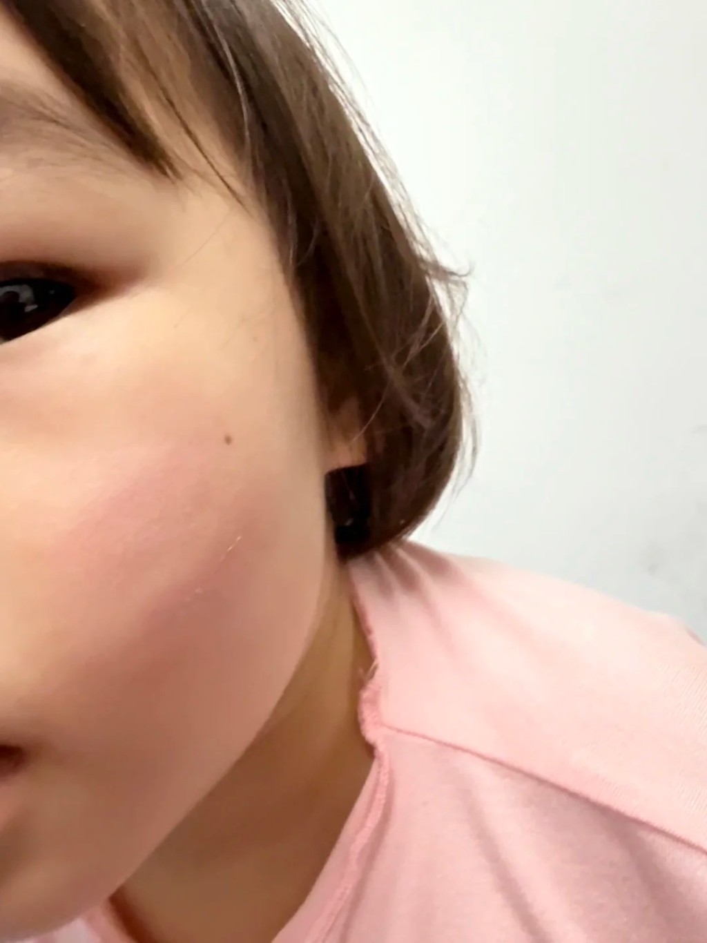 楊先生及女兒身體多處擦傷。 楊先生及女兒身體多處擦傷。