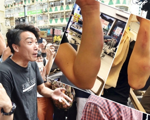 岑子杰去年8月底與友人在餐廳用膳時遭人伏擊。資料圖片