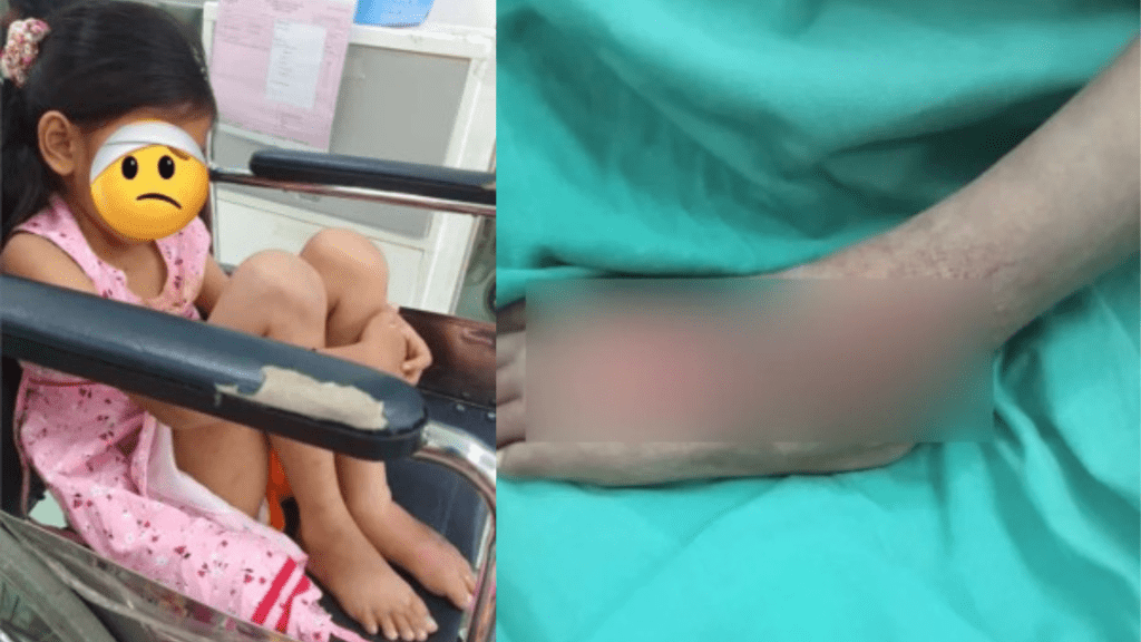 網民爆料附上受害女童傷勢照片。 X