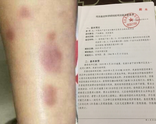 浙江五旬男子要求送院不果。微博圖