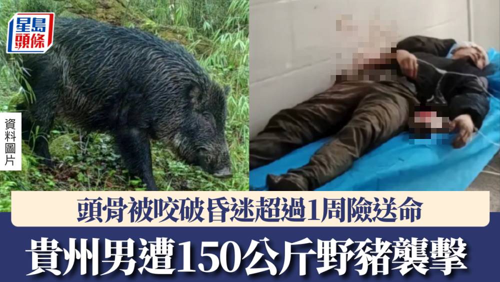 貴州男遭150公斤野豬襲擊,頭骨被咬破昏迷超過一星期險送命。