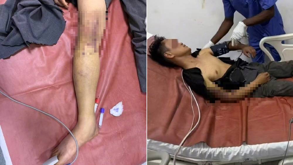 非洲遭綁架被打斷手腳，27歲網紅冒險跳車逃生。