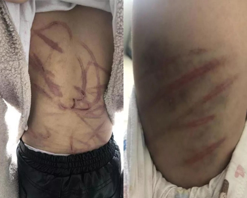 揚州一位市民向內地傳媒報料稱,當地一名10歲女童遭遇父母家暴。 網上圖片