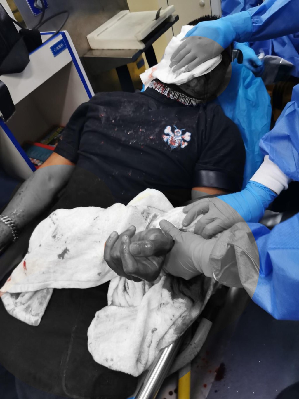 去年8月，黃竣鋒在深圳旗艦店遭兇徒連斬3刀，導致臉部、左手及左腰嚴重受傷。