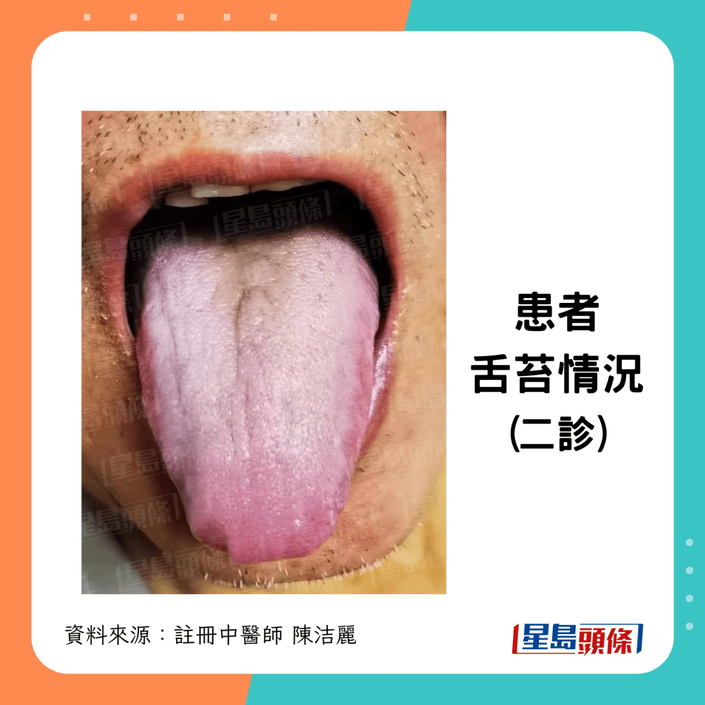 二诊时舌苔情况