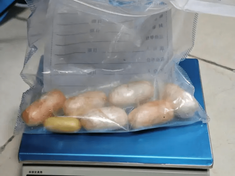 黑人男子排出7顆可卡因毒丸,重337.88克。 黑人男子排出7顆可卡因毒丸,重337.88克。