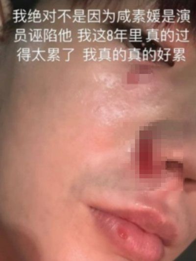 陈华在IG上分享限时动态发文，提到：「我绝对不是因为咸素媛是演员诬陷她，我这8年里，真的过得太累了，我真的真的好累」。