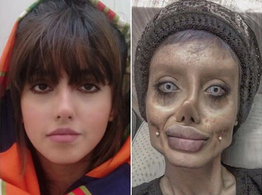 塔瓦爾整容前的照片(左)。