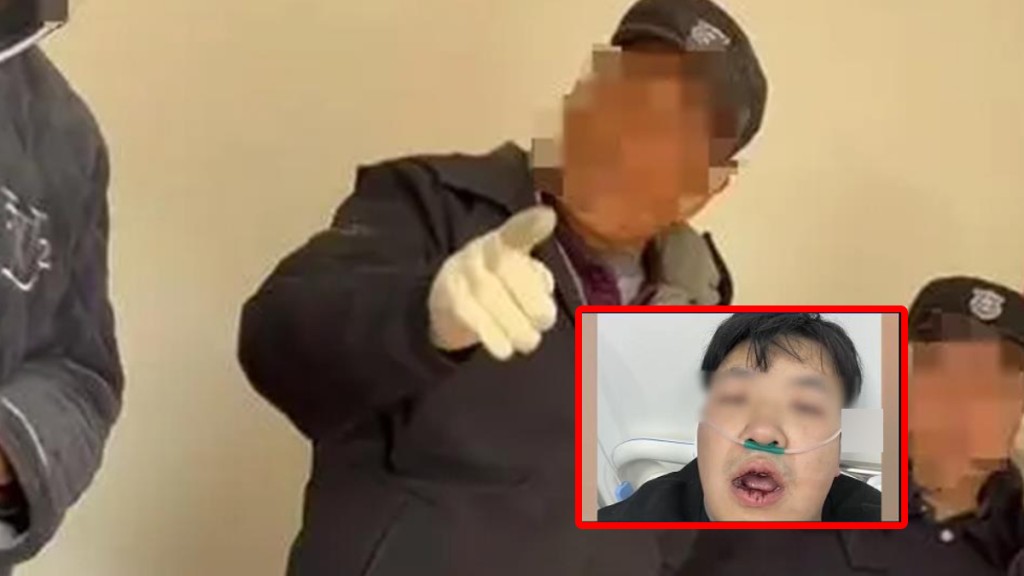 陝西馬先生因為在群組鬧物管，被保安上門報復摑嘴要入院。