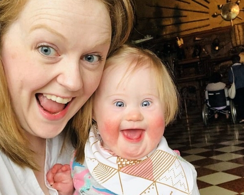 英国一名妈妈Helen，育有一名患唐氏综合症的2岁女儿Eleanor Manton。网图