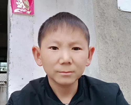 朱聖開的容顏停留於6-7歲的階段。(網圖)