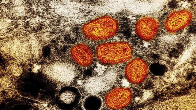 猴痘1970年首次在非洲刚果被发现。 资料图片