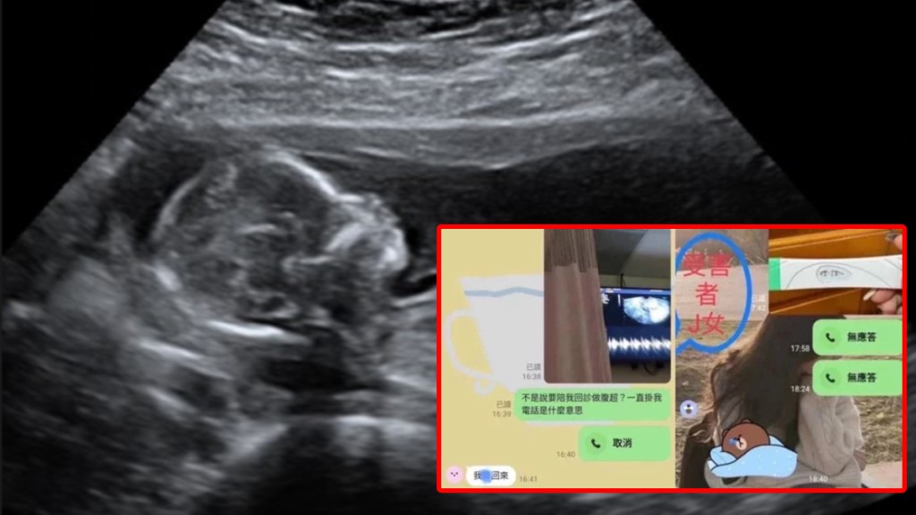 台灣傳有男護士與10名女護有染，更令4人懷孕。