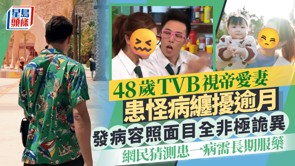 48歲TVB視帝愛妻患怪病纏擾逾月  發病容照面目全非極詭異  網民猜測患一病需長期服藥