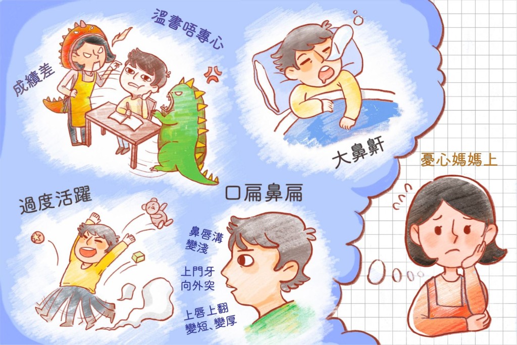 兒童睡眠窒息症可影響孩子臉部發育、導致哨牙，長期缺氧會影響腦部發育，對健康及學習都會造成嚴重影響。（圖片：邱騏驄醫生提供）