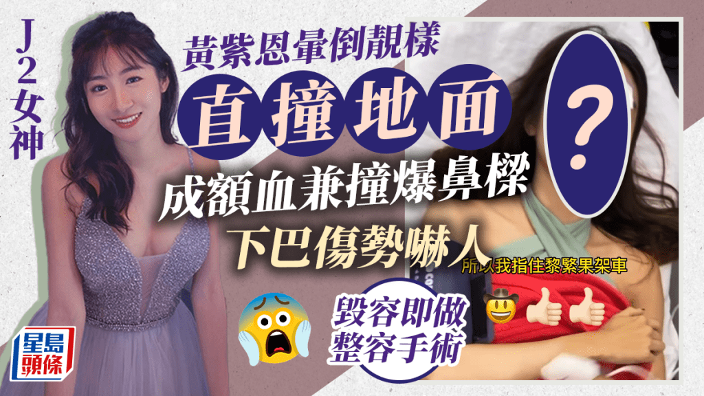 J2女神黃紫恩暈倒靚樣直撞地面！成額血兼撞爆鼻樑下巴傷勢嚇人 毀容即做整容手術