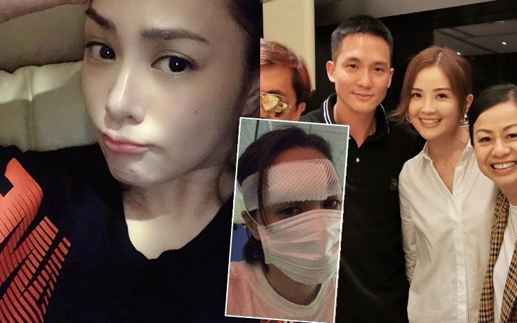 6日後拆線的阿嬌,期待傷疤唔顯眼。另好姊妹阿Sa就一口否定和男友鬧分訊。