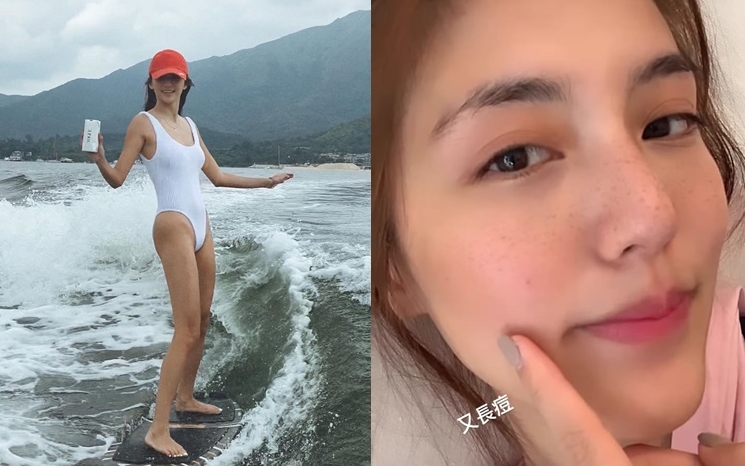 吴千语滑浪晒出一脸雀斑，感觉可爱。