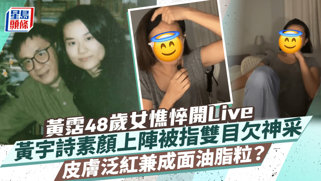 黃霑48歲女黃宇詩憔悴開Live成面油脂粒？ 素顏上陣皮膚泛紅被指雙目欠神采