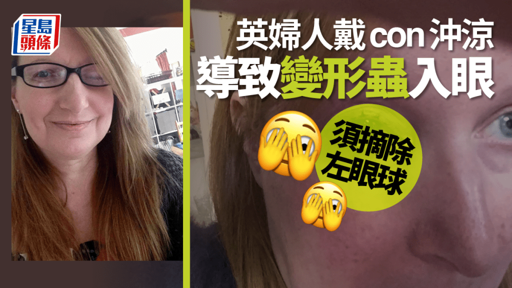 英國一名女子習慣在洗澡時戴著隱形眼鏡,竟導致眼睛受感染。