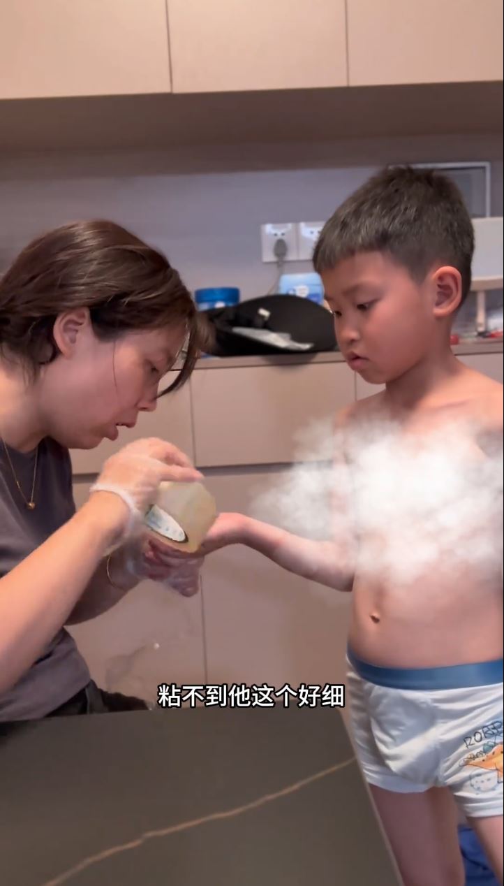 “虫妈”用封箱胶纸为儿子清除刺入皮肤的玻璃纤维。抖音