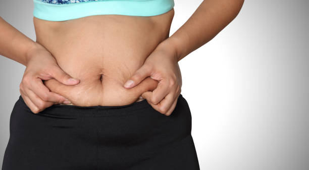 易肥人士可通过后天来养成易瘦体质。