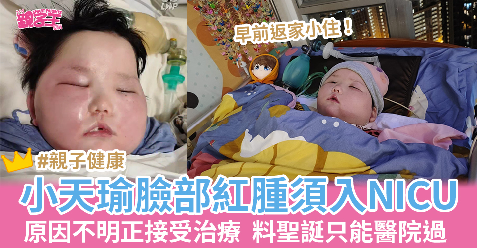 天瑜2018年患横纹肌肉瘤，2020年手术时不幸遭遇医疗事故变「植物人」。（图片来源：Facebook@天瑜医疗事故关注组）