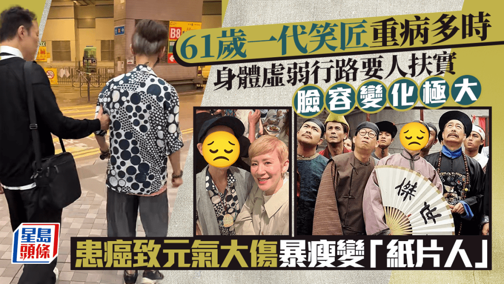 61歲「笑匠」身體虛弱行路要人扶  曾患癌元氣大傷健康狀況惹關注  近年暴瘦似紙片人