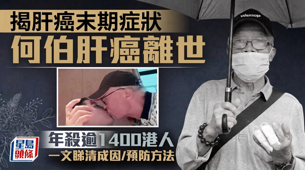 何伯肝癌离世｜肝癌末期症状公开 年杀逾1400港人 附患病成因/预防方法
