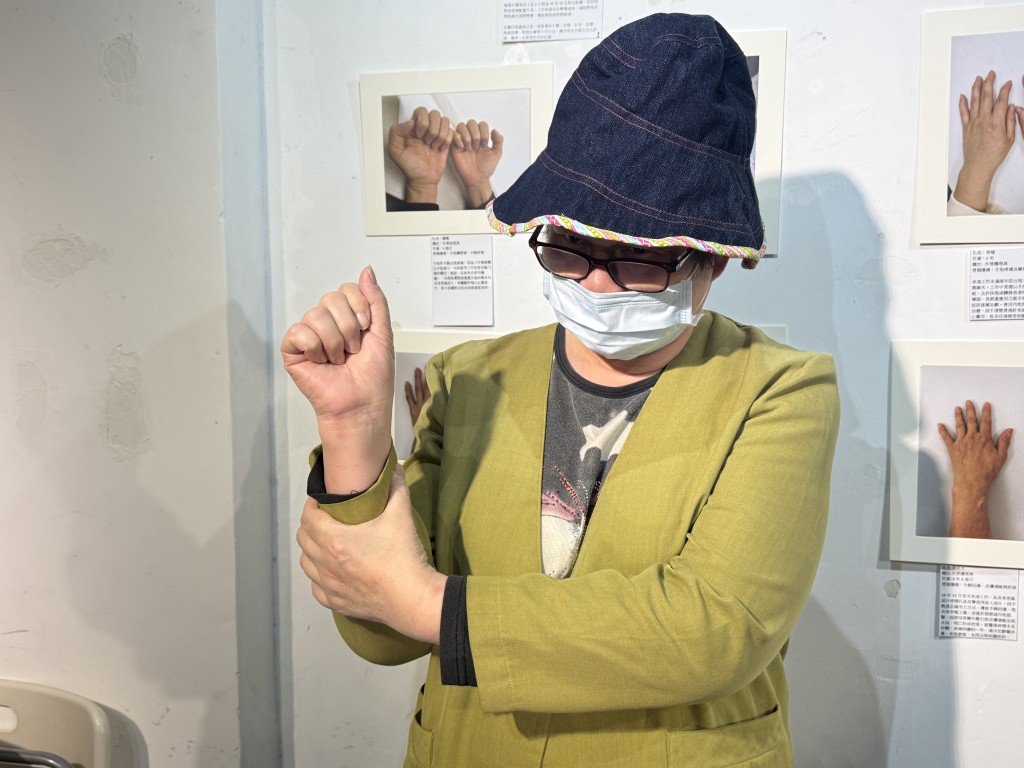 現時任職夜更護理員69歲的陳女士（化名）手腕、腳踭及膝蓋均出現不同程度的勞損。